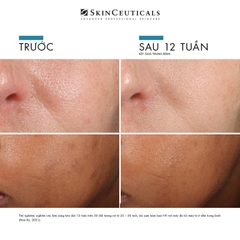 SKINCEUTICALS PHLORETIN CF: Tinh Chất Chống Oxy Hóa Mạnh Mẽ, Sáng Da & Cải Thiện Đốm Nâu