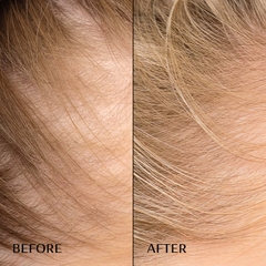 M2 BEAUTÉ HAIR ACTIVATING SERUM/ SERUM KÍCH HOẠT TÓC, MỌC TÓC CHẮC KHOẺ VÀ GIẢM RỤNG TÓC
