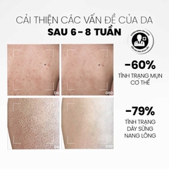 MDCARE AHAS & BHA EXFOLIATING BODY WASH / SỮA TẮM GIẢM  MỤN & TẨY TẾ BÀO CHẾT