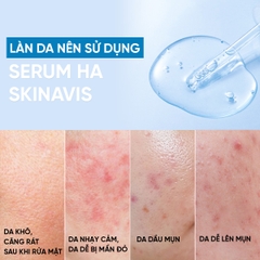 SKINAVIS HYALURONIC ACID SERUM: Cấp Ẩm Đa Tầng, Phục Hồi & Làm Dịu Làn Da Khô, Nhạy Cảm
