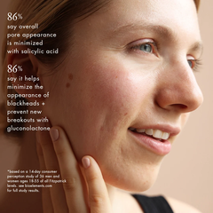 Bioelements Peel Breaker – Tinh Chất Tẩy Tế Bào Chết 1,5% BHA Và 0,5% PHA Làm Thông Thoáng Lỗ Chân Lông