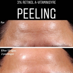 NEOSTRATA PROSYSTEM RETINOL PEEL – Tinh Chất Thay Da Sinh Học Giúp Tinh Chỉnh Bề Mặt, Giảm Mụn Và Nuôi Dưỡng Da Mịn Màng