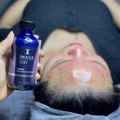 SIGNATURE FACELIFT®: Phục Hồi Làn Da Nhạy Cảm, Giãn Mao Mạch Tối Ưu