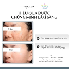 CHRISTINA NUANCE: Giải Pháp Trẻ Hóa Sinh Học Độc Quyền Tái Cấu Trúc ECM