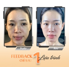 LINERASE COLLAGEN: ĐỈNH CAO TRẺ HÓA SINH HỌC CHUẨN Y KHOA TỪ CHÂU ÂU