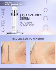 TEOXANE [R] ADVANCED SERUM: Tinh Chất Chống Lão Hóa Thế Hệ Mới - Hiệu Quả Tương Đương Retinol, Không Kích Ứng