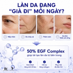 HISTOLAB 50% EGF COMPLEX AMPOULE: Tinh Chất Trẻ Hóa Chuyên Sâu – Tái Tạo, Giảm Nhăn & Sáng Da