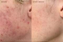 PHARMAFORM PRE & POSTBIOTICS SYNERGY SERUM: Tinh Chất Phục Hồi & Tăng Cường Sức Đề Kháng Da