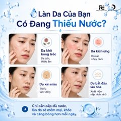 HISTOLAB HYALURON COMPLEX AMPOULE 62%: Tinh Chất Cấp Ẩm Thiết Yếu – Tái Tạo, Làm Dịu & Căng Bóng Da