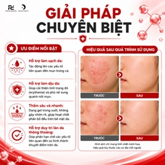 Acnewar Gel 15g: Giải Pháp Kháng Khuẩn, Giảm Sưng Viêm Và Điều Trị Mụn Hiệu Quả