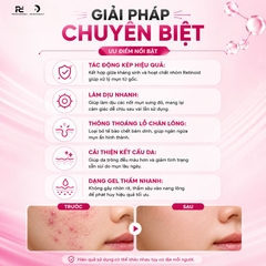 Acnewar Plus Gel 15g: Giải Pháp Đột Phá Cho Mụn Trứng Cá Và Mụn Viêm sưng