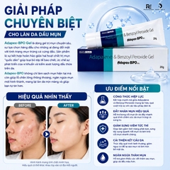 Adapex-BPO Gel: Giải Pháp "Diệt Mụn" Chuyên Sâu Với Adapalene & Benzoyl Peroxide