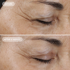 IMAGE Skincare AGELESS+ Retinol Overnight Masque 0.5% Retinol Complex – Mặt nạ ngủ retinol cấp ẩm và chống lão hóa