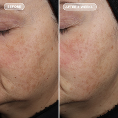 IMAGE Skincare AGELESS+ Retinol Pure Liquid Retinol 0.3% – Serum retinol dành cho da đã thích nghi da hỗn hợp, da dầu