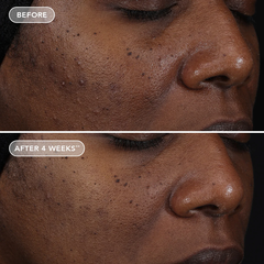 IMAGE Skincare AGELESS+ Retinol Repair Crème 0.3% Retinol Complex – Kem dưỡng retinol làm sáng và chống lão hóa cho người mới bắt đầu, da nhạy cảm, da khô.