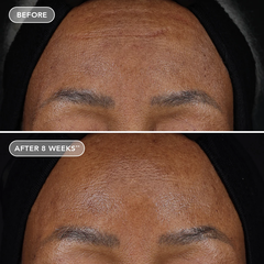 IMAGE Skincare AGELESS+ Retinol Treatment Crème 1.2% Retinol Complex – Kem retinol nồng độ cao chống lão hóa chuyên sâu