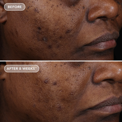 IMAGE Skincare AGELESS+ Retinol Treatment Crème 1.2% Retinol Complex – Kem retinol nồng độ cao chống lão hóa chuyên sâu