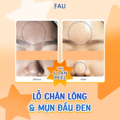 FAU Shiny Pumpkin Peel – Giải Pháp Thay Da Sinh Học Dịu Nhẹ Từ Enzyme Bí Đỏ Đậm Đặc