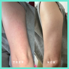 PHARMAFORM SMOOTHING INTENSE MOISTURE BODY LOTION: Sữa Dưỡng Thể Chuyên Sâu - Giảm Viêm Nang Lông & Mụn Lưng