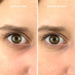 LACABINE BOTULINUM EFFECT EYE CONTOUR / KEM LÀM SÁNG VÀ LÀM GIẢM BỌNG MẮT