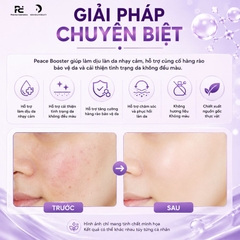 CELL SHOCK PEACE BOOSTER - 5% NIACINAMIDE + 2% TRANEXAMIC ACID (20ML)