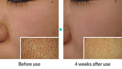 PHARMAFORM BLUE REVITALIZE CREAM: Kem Dưỡng Phục Hồi Chống Ánh Sáng Xanh, Tái Tạo Làn Da Săn Chắc