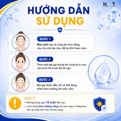 Clindamycine and Adapalene Gel Melacare Acne 15g: Giải Pháp Giảm Mụn Viêm Chuyên Sâu