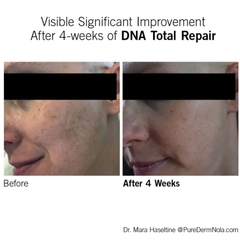 NEOVA DNA TOTAL REPAIR / SERUM CHỐNG OXY HÓA, XÓA NHĂN, GIẢM NÁM