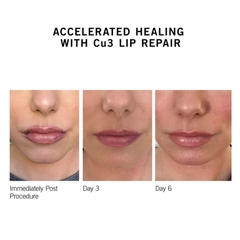 NEOVA CU3 LIP REPAIR / DƯỠNG ẨM, TRỊ THÂM & CĂNG BÓNG MÔI