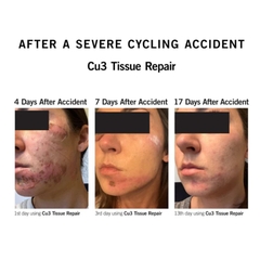 NEOVA CU3 TISSUE REPAIR COPPER PEPTIDE COMPLEX / KEM DƯỠNG PHỤC DA SAU LASER, MESO, BỎNG