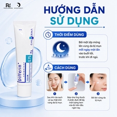 DIFFERIN CREAM 0.1%: Kem Đặc Trị Mụn Chứa Adapalene – Giảm Mụn Viêm & Cải Thiện Làn Da