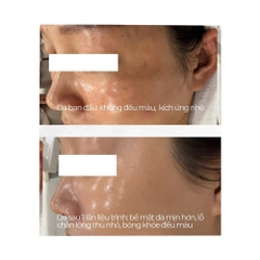 RESURFACE²: Liệu Trình Peel Tái Tạo Tế Bào & Trẻ Hóa Chuyên Sâu Từ Ý