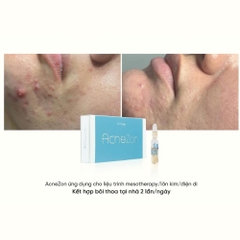 DERMICA ACNEZON: Giải Pháp Meso Tiêu Viêm, Ngăn Sẹo Mụn Cấp Tốc