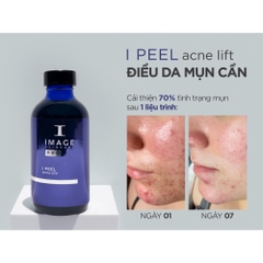 ACNE LIFT® THANH LỌC DA: Chấm Dứt Tình Trạng Bít Tắc và Mụn Ẩn