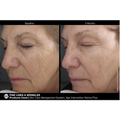 Jan Marini Age Intervention® Retinol Plus – Kem Dưỡng Chuyên Sâu Hỗ Trợ Ngăn Ngừa Lão Hóa Và Làm Mịn Bề Mặt Da