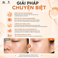 KLAPP Niacinamide Triple Action Refine 10% Serum: Tinh Chất Trẻ Hóa, Se Khít Lỗ Chân Lông & Phục Hồi Hệ Vi Sinh Da