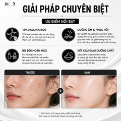LA CABINE NIACINAMIDE [PRO] CREAM - Kem Dưỡng Sáng Da, Mờ Thâm Nám, Phục Hồi Với 15% Niacinamide