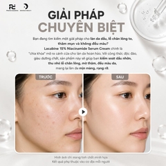 LACABINE 15% NIACINAMIDE SERUM CREAM / TINH CHẤT DƯỠNG SÁNG, MỜ THÂM DA