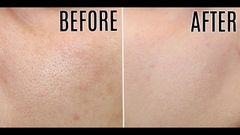 PHARMAFORM ENZYME CLEANSER GEL: Sữa Rửa Mặt Tẩy Da Chết & Cấp Ẩm Dịu Nhẹ