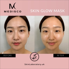 MEDISCO SKIN GLOW MASK: Mặt Nạ Collagen Peel-off – Nâng Cơ, Tái Tạo & Phục Hồi Da Sau Trị Liệu