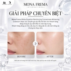 MONA FREMA White-Equation Reinforcing Concentrate 30ml – Tinh chất duy trì hiệu quả dưỡng sáng, hỗ trợ cải thiện da xỉn màu