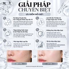 MONA FREMA WHITE-EQUATION COMPLEX SERUM: Tinh Chất Dưỡng Trắng & Cải Thiện Sắc Tố Da Chuyên Sâu