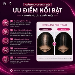 Nanofall Hair Supplement: Viên Uống Mọc Tóc Bản Cải Tiến Với Biotin 10000mcg – Giải Pháp Cho Mái Tóc Dày Khỏe