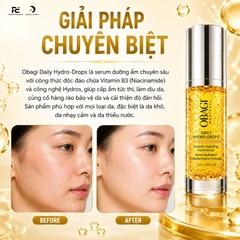 Obagi Daily Hydro-Drops Facial Serum: "Cứu tinh" cho làn da thiếu ẩm và nhạy cảm 