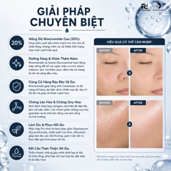 OH!OH! SKIN HEALTH SERUM (with 20% Niacinamide & 2% Acetyl Glucosamine) : Tinh Chất Kiểm Soát Bã Nhờn & Dưỡng Sáng, Mờ Thâm Mạnh Mẽ