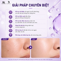 Paula's Choice Clinical Niacinamide 20% Treatment: Tinh Chất Thu Nhỏ Lỗ Chân Lông & Sáng Mịn Bề Mặt Da