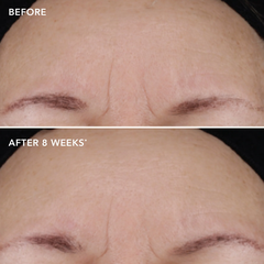 IMAGE Skincare AGELESS+ Retinol Treatment Crème 1.2% Retinol Complex – Kem retinol nồng độ cao chống lão hóa chuyên sâu