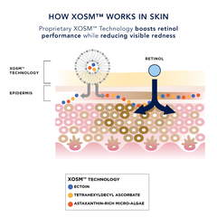 IMAGE Skincare AGELESS+ Retinol Repair Crème 0.3% Retinol Complex – Kem dưỡng retinol làm sáng và chống lão hóa cho người mới bắt đầu, da nhạy cảm, da khô.