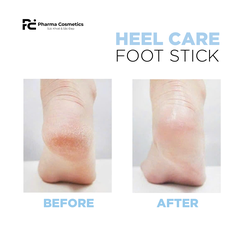 HEEL CARE FOOT STICK / THĂN LĂN DẠNG THỎI CHĂM SÓC GÓT CHÂN, GIÚP LÀM MỀM VÀ GIẢM NỨT NẺ GÓT CHÂN
