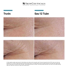 SKINCEUTICALS P-TIOX: Tinh Chất Peptide Tiên Tiến Giúp Cải Thiện & Làm Mờ 9 Loại Nếp Nhăn